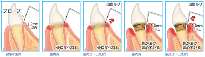 池上通り歯科｜大田区池上で歯医者をお探しの方は当院まで
