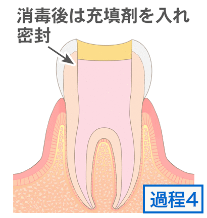 池上通り歯科｜大田区池上で歯医者をお探しの方は当院まで