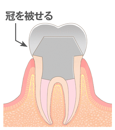 池上通り歯科｜大田区池上で歯医者をお探しの方は当院まで